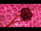 Cancer Growth Animation