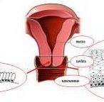 120819_cervical_erosion_2.jpg